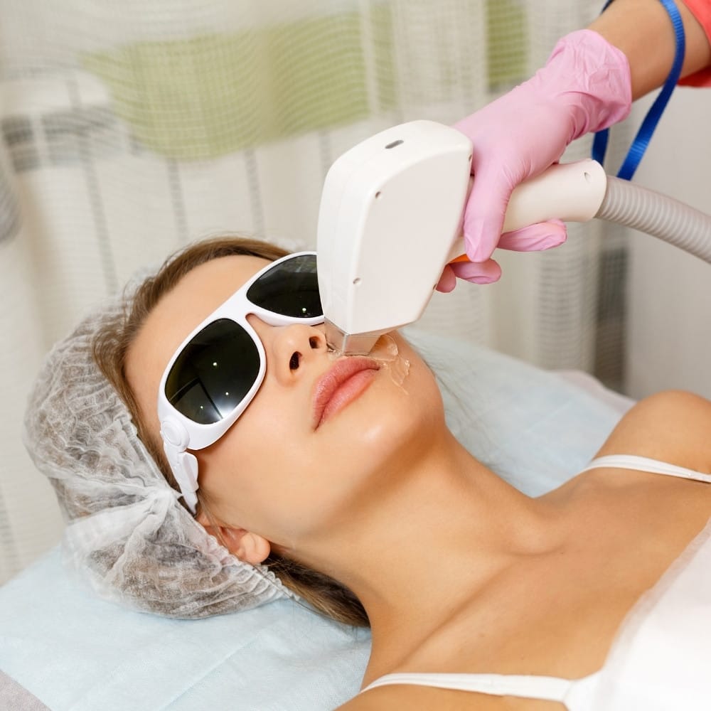Laser hair removal treatment in Cambridge ON — Silkentouch diode laser session