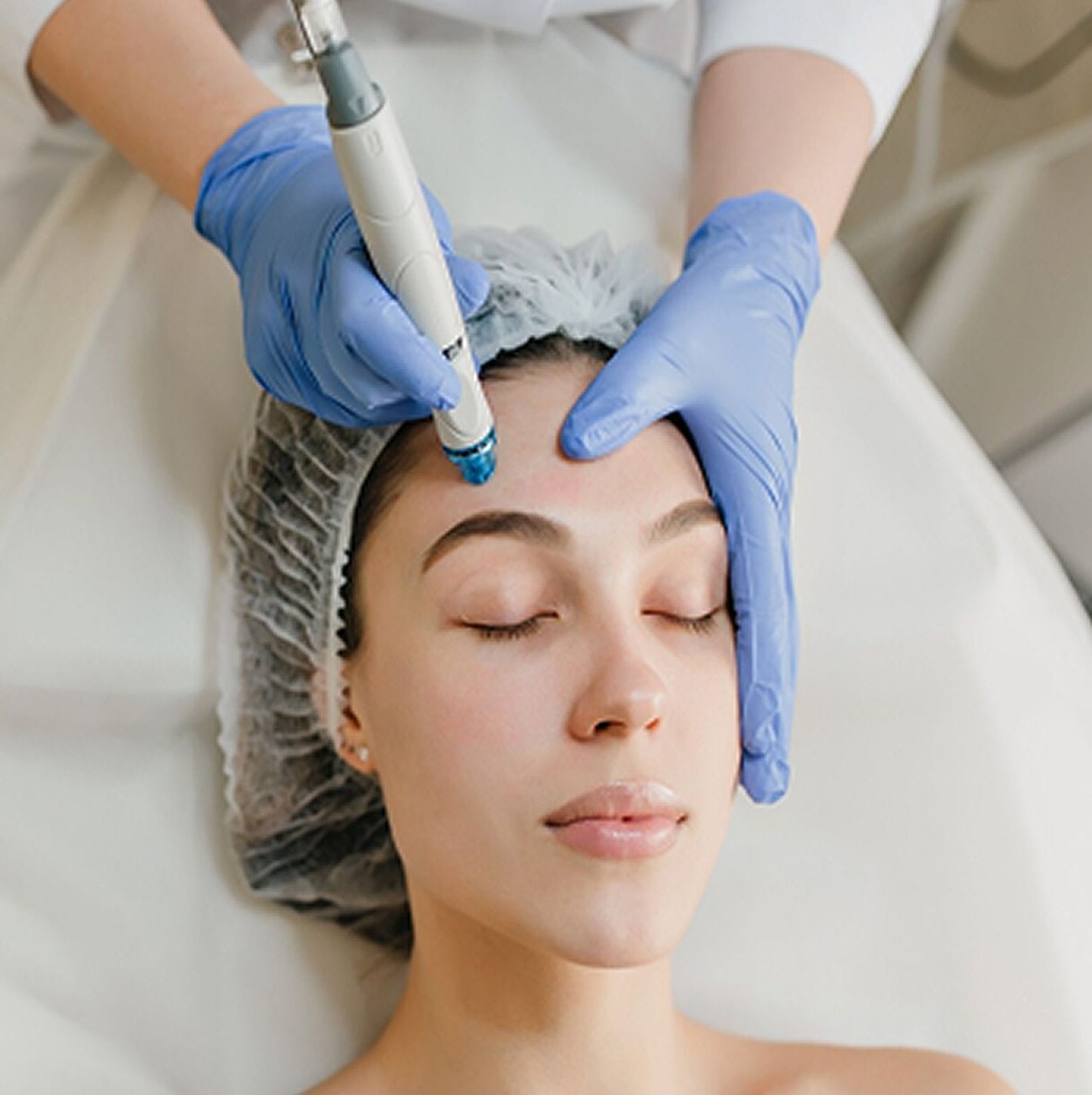 Scalp microneedling for hair restoration at Silkentouch Aesthetics